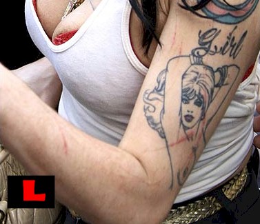 Amy Winehouse Arm (PICTURE)! Mag questions marks on Winehouse Arm
